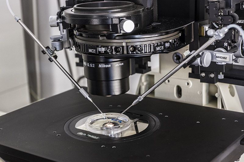 EmbryoScope+ — monitoraggio embrioni